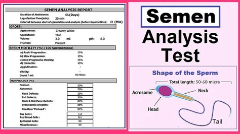 Normal sperm count: A guide to semen analysis